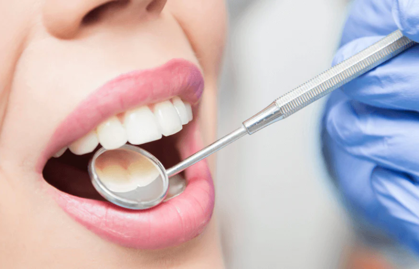 Pasirūpinkite savo šypsena jums tinkamu metu!